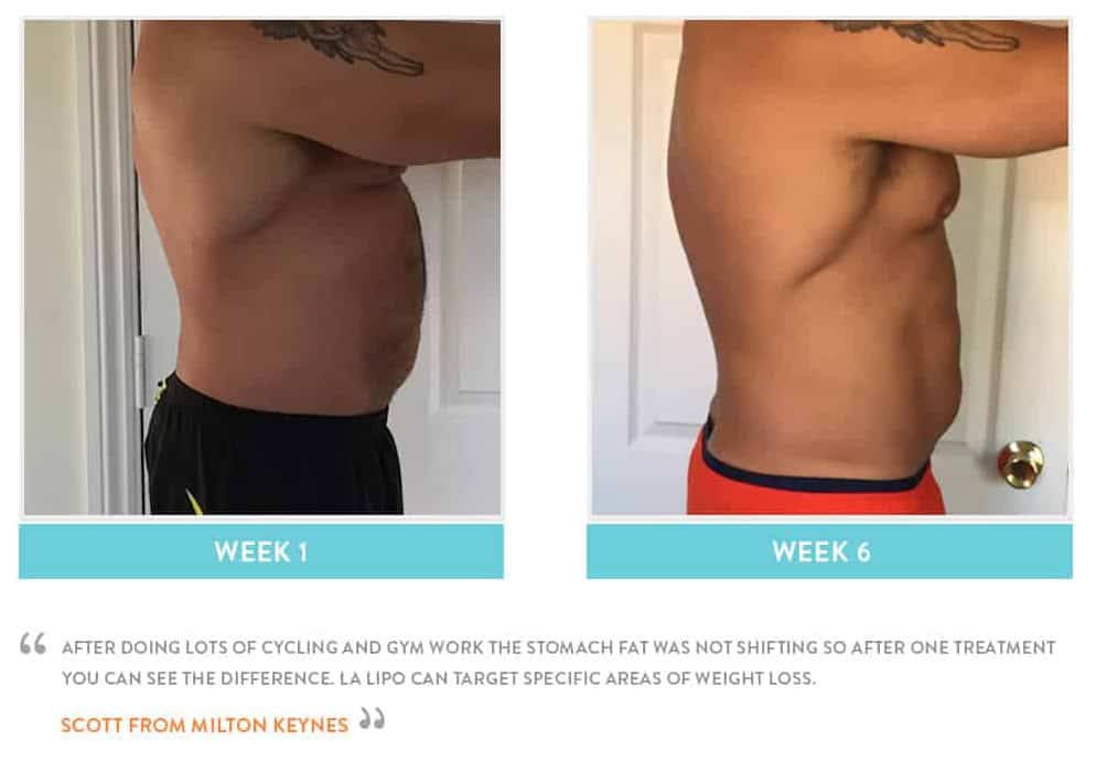 Before & After Stomach Fat Hungerford