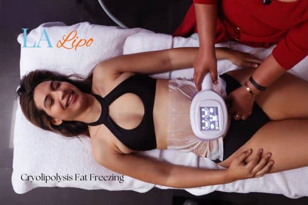 woman getting cryolipolysis Hungerford