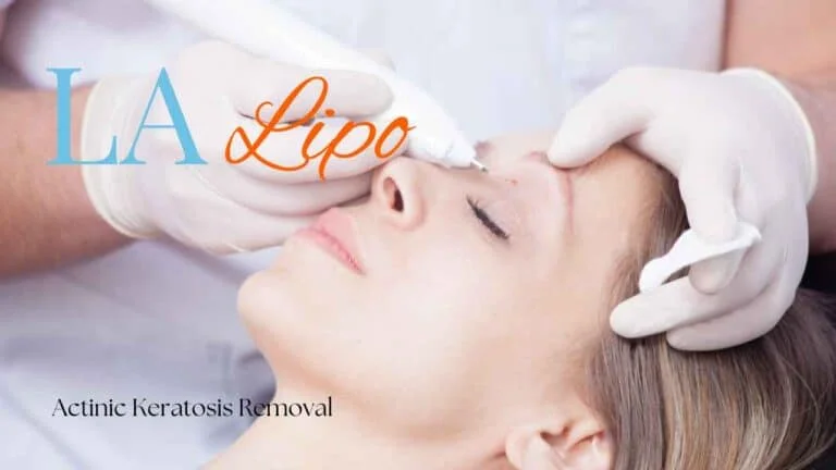 Woman receiving Actinic Keratosis Removal Treatment Hungerford