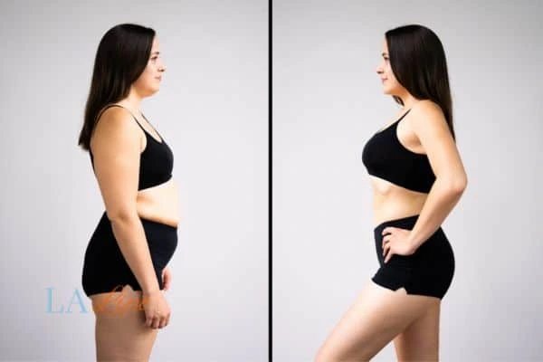 LA-EMS Body Sculpting Hungerford results before and after of womans results on body toning.