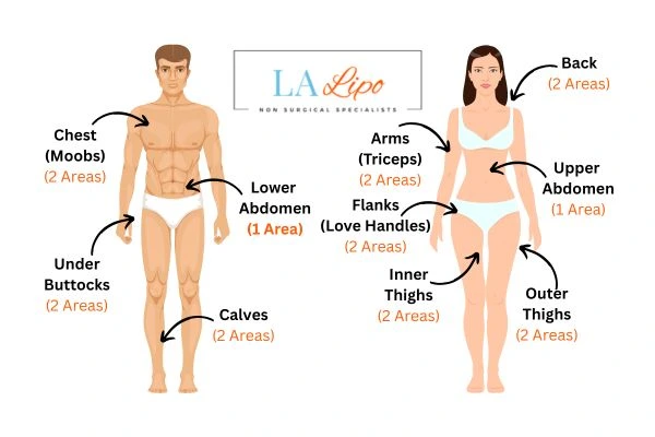 LA LIPO Cryolipolysis Areas Hungerford