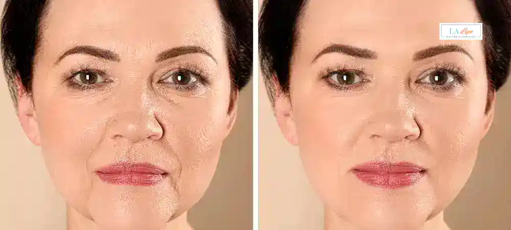 Why Aren’t My Skincare Products Making My Sagging Skin Look Firmer Hungerford?