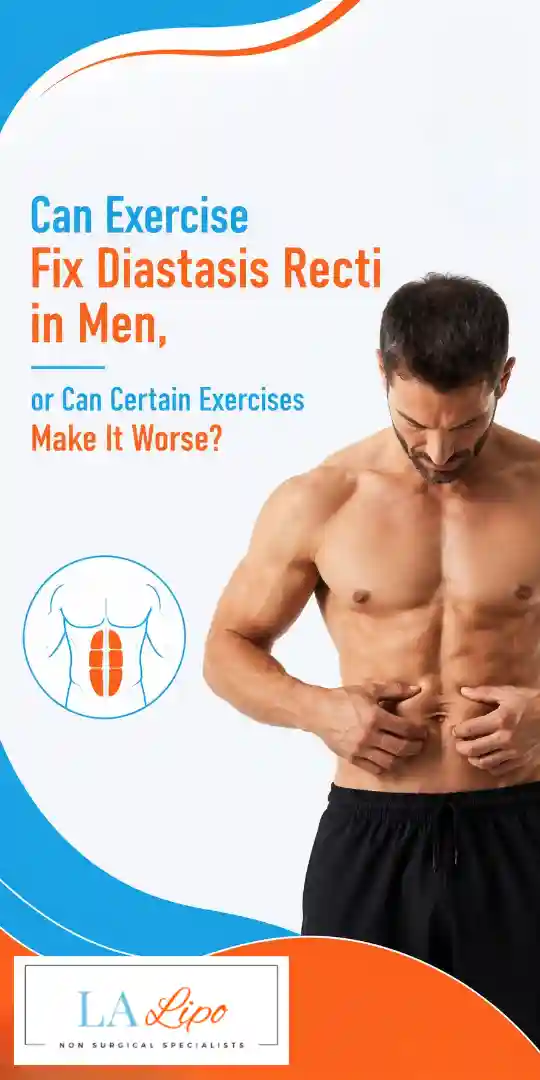 Can Exercise Fix Diastasis Recti in Men, or Can Certain Exercises Make It Worse Hungerford?